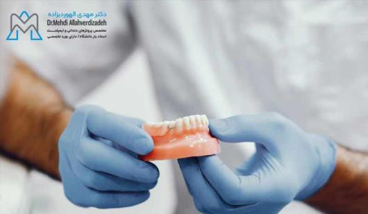 پروتز دندان در مطب دکتر الهوردیزاده