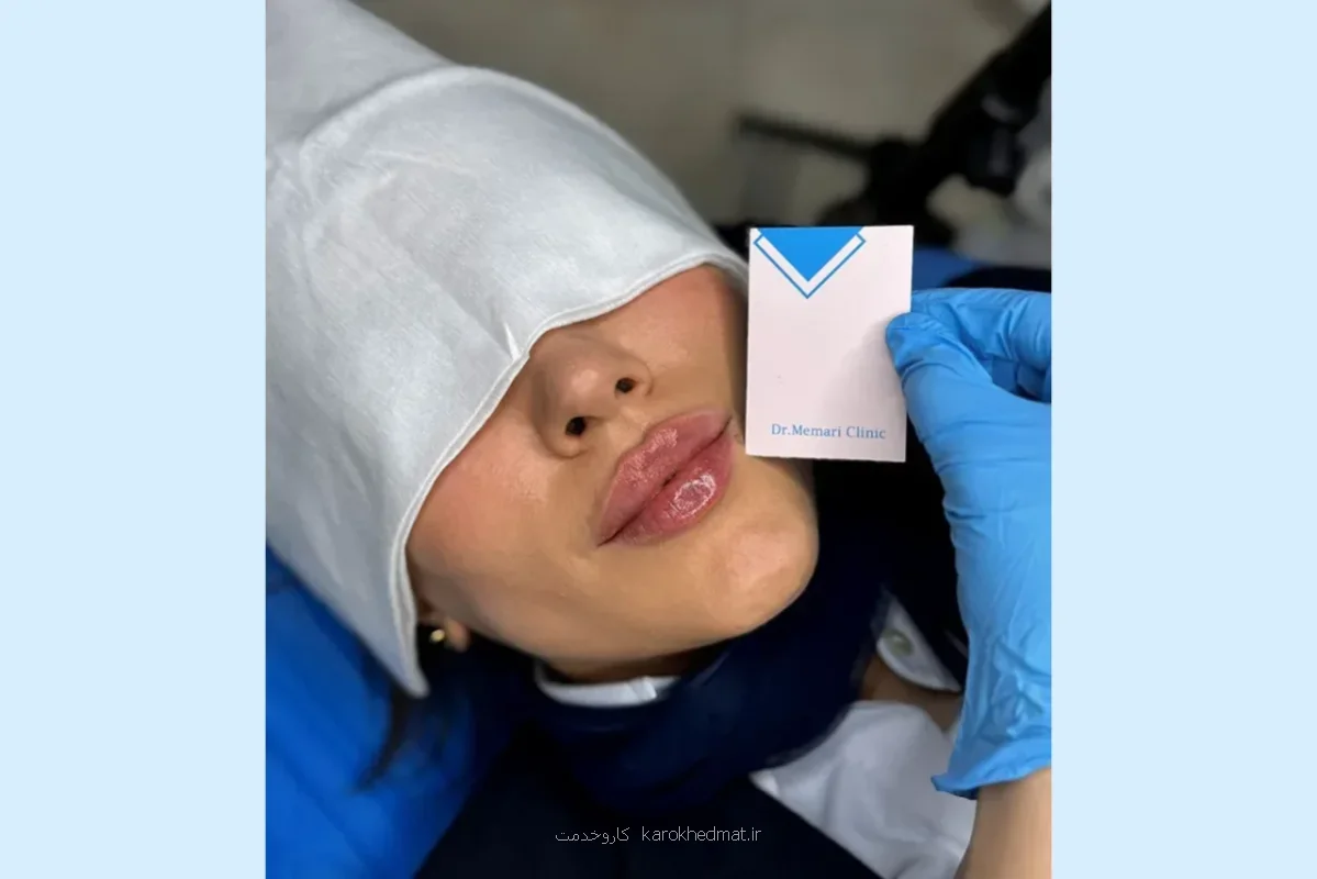 پروسه تزریق فیلر لب ایده آل