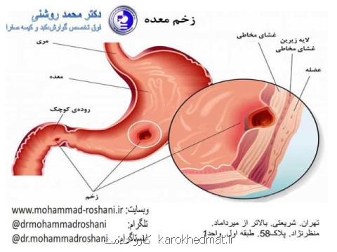 آندوسكوپی معده